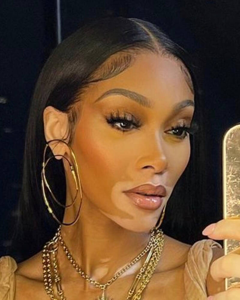 Winnie Harlow